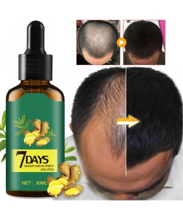 Ginger hair growth oil 30 ml ginger hair growth essential oil ginger hair treatment oil hair growth solution essential oil against hair loss shampoos - Buy Online on GoSupps.com