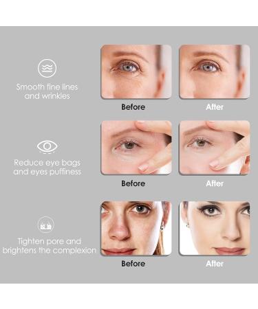 Facial Ice Globes Roller for Tighter, Anti-Ageing Skin - Reduce Puffiness & Wrinkles | Daily Beauty Tool for Face, Neck & Eyes - Buy Online on GoSupps.com