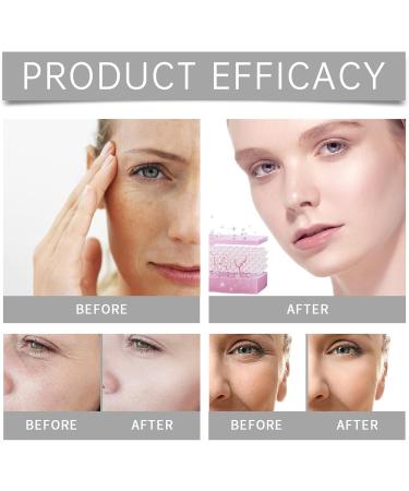 Shantou Youjia Micronadel Infusions Anti Aging Serum Set micro infusion set with hyaluronic acid for radiant skin care set for whitening and antiwrinkles micro infusion system for lips and face - Buy Online on GoSupps.com