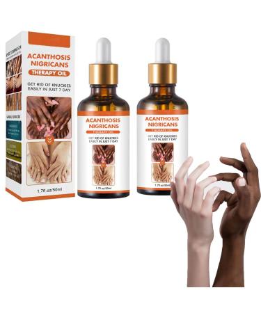 Knachohel Acanthosis Nigricans Therapy Oil Acanthosis Nigricans Treatment Dark Spot Corrector Oil Dark Spot Remover Lighten Body Black Skin 2pack