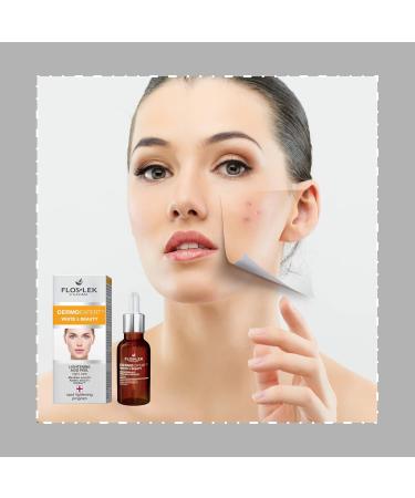 FLOSLEK Whitening Brightening Face Acid Night Peeling | 30 ml | Lightens Moisturizes Softens & Evens Skin Colour | Smoother & Brighter Complexion | Reduces the Intensity of Blemishes - Buy Online on GoSupps.com
