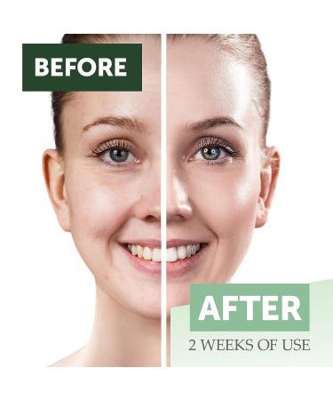 Measurable Difference Collagen Retinol Serum - Anti-Aging Facial Serum for Wrinkles & Fine Lines - 1 Oz Pump Bottle for Skin Elasticity & Acne Reduction - Buy Online on GoSupps.com