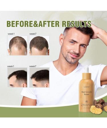 Hair Growth Serum with Radix Polygonum Multiflorum - Fight Hair Thinning & Fall | 50ml | Strengthen & Thicken Hair for Men & Women - Buy Online on GoSupps.com