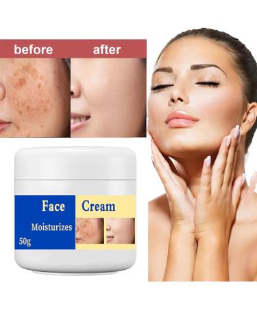 Melasma Treatment for Face Removes Facial Melasma Dark Spots Spot Cream Hyperpigmentation Treatment Sun Spots and Melasma Freckle Remover Remove Dark Spots Pigmentation Removal Cream for Face - Buy Online on GoSupps.com