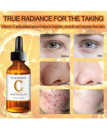 Vitamin C Serum for Face - Hyaluronic Acid Anti-Aging Serum Brightens Dark Spots & Evens Skin Tone | 30 ml - Buy Online on GoSupps.com