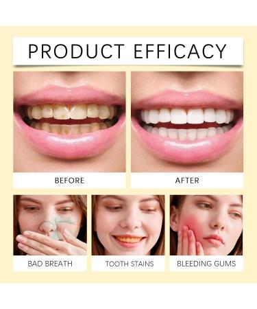 Ginger Toothpaste for Gentle Brightening & Enamel Support Refreshing Flavor Daily Oral Care(1pcs) - Buy Online on GoSupps.com