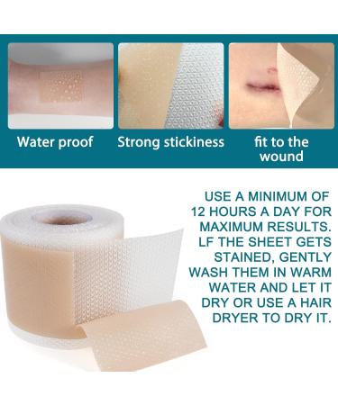 Silicone Scar Treatment Rollers - Heal C-Section Burns Keloids & Acne | 4cm x 320cm | Free Shipping Worldwide - Buy Online on GoSupps.com