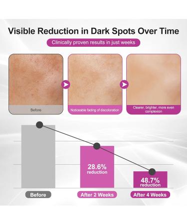 Dark Spot Remover for Face and Body Age Spot Sun Freckles Brown Corrector Serum Skin Care Face Serum with 360 Roller Contains Vitamin C Glutathione and Niacinamide for All Skin Types (0.7 Fl Oz) - Buy Online on GoSupps.com