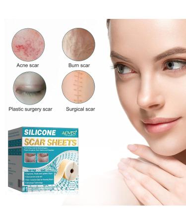 Weida Sign Silicone Scar Sheets 1.6x120 Inch - Professional Grade for Surgery Scars, C-Section, Burn, Acne, Keloid - Soft & Reusable - 3M - Buy Online on GoSupps.com