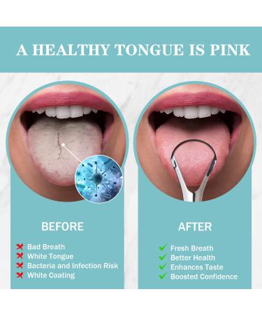 2 Pack Stainless Steel Tongue Scraper for Adults & Kids - Oral Care Tool to Reduce Bad Breath - Buy Online on GoSupps.com