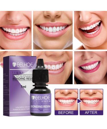 Tooth Jewelry Gemkit - Professional DIY Tooth Gemstone Kit for Stunning Tooth Decoration | Complete Teeth Gems Kit with Lamp & Glue - Buy Online on GoSupps.com