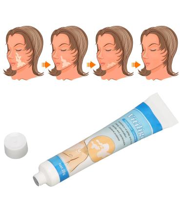 LIULDASHUN Vitiligo Cream - Natural Herbal Extract Treatment Ointment for Skin Pigmentation - 0.7oz - Buy Online on GoSupps.com