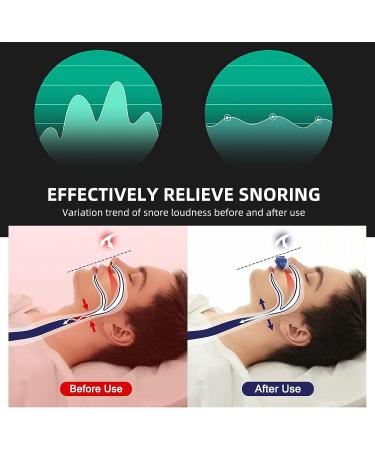 Double Eddy Current Electric Anti Snoring Solution for Men and Women - Stop Snoring with Nasal Dilator Nose Vents - Buy Online on GoSupps.com