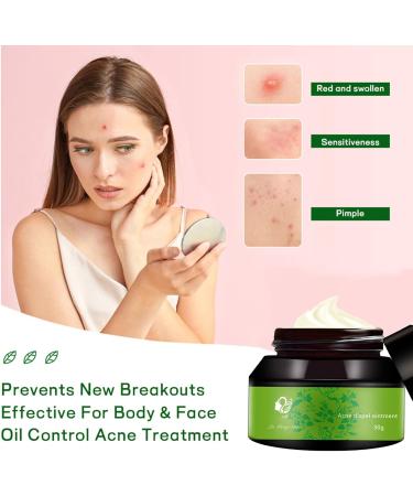 Chinese Herbal Acne Treatment Cream Natural Extract Acne & Spot Treatment for Face Acne Cream & Spot Cream for Face Pimple Cream for All Skin Types Smooth Gentle Acne Repair Oil Control - Buy Online on GoSupps.com