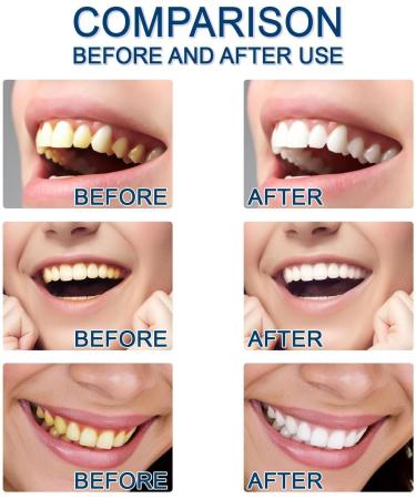 Pure Smile Essence Teeth Whitening Enhancer At-Home Whitening System Professional Teeth Whitening Powerfully Removes All Kinds of Stains - Buy Online on GoSupps.com