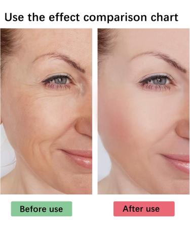 5 Seconds Wrinkle Remover 5 Seconds Retinol Anti-Wrinkle Cream 5 Seconds Anti Wrinkle Face Cream Instant Wrinkle Remover Lifting Moisturizing Facial Cream Tightening Face Cream or Women - Buy Online on GoSupps.com