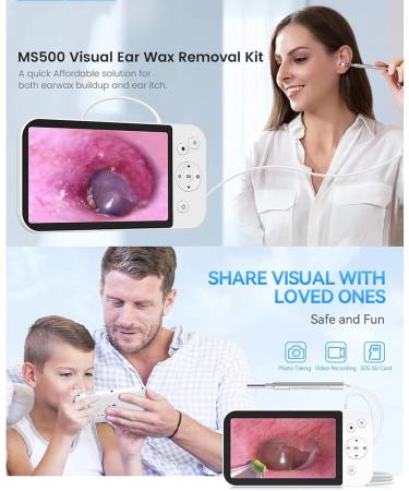 BAIXDM 5-Inch Portable LCD Photo Camera - 1920x1080 Resolution USB Digital Storage Ear Wax Removal Tool - Buy Online on GoSupps.com