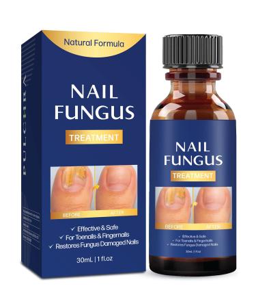 Toenail fungus treatment, Nail Fungus Treatment for Toenail, Toe Nail Fungus Treatment Extra Strength Effective Fingernail and Toenail Fungus Killer,Nail Repair Solution, Restoring Healthy Nails