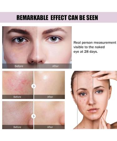 Skincare Set Gifts for Teenagers Girls Skincare Gift Set Women with Hyaluronic Acid 2%+B5 Face Serum Niacinamide Serum Vitamin C Face Moisturiser Hydrating Facial serum Anti Aging Serum for Face - Buy Online on GoSupps.com