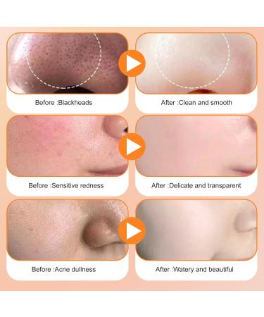  Sloane Oil Control Deep Pore Cleansing Mud with Carrot | Clay Mud for Blackheads and Pores Bubble Treatment for Radiant Skin Reduction - Buy Online on GoSupps.com