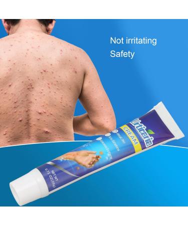 Anti-itch Cream Pain Relief Urticaria Relief Itching Ointment Dry Skin Adjuvant Treatment Microbiome Maintenance 20g - Buy Online on GoSupps.com