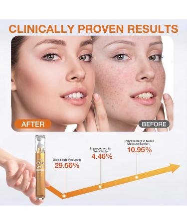 Dark Spot Remover For Face Skin Care Serum Dark Spot Corrector For Face Age Spot Remover with Massage Roller (0.67 Fl Oz) Unscented - Buy Online on GoSupps.com