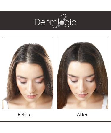 Extra Strength Hair Growth Serum - DHT Blocker for Fuller, Thicker Hair Growth - Men & Women, No Side Effects - Buy Online on GoSupps.com