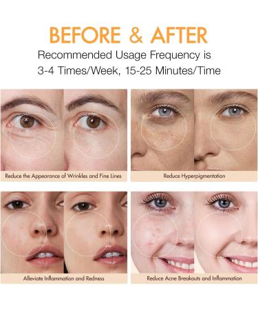 Red Light Therapy Mask | 3 Energy Modes | 560 Beams | Rechargeable | Lightweight & Auto-Off | Perfect Gift for Her - Buy Online on GoSupps.com