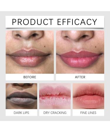  Nuvilo Lip Lightening for Dark Lips Brightening Lip Balm Lip Exfoliator for Lips and Lips to Lighten Natural Moisturizing Balm Reduce Fine Wrinkles and Discoloration (4 Pcs) - Buy Online on GoSupps.com