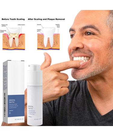 Dental Gel with Antioxidants - Oral Gum Care for Healthy Gums 1 fl. Oz / 30ml - Shop Now - Buy Online on GoSupps.com