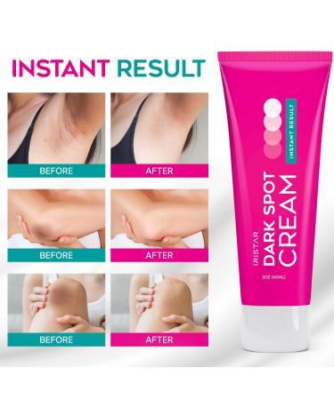 Best Dark Spot Remover Cream for Face & Body | Age & Brown Spot Remover | Effective Skin Treatment - Buy Online on GoSupps.com