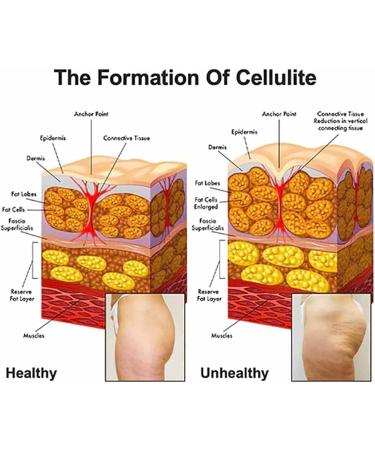 Squalane Reduce Celluli Body Scrub Organic Avocado Body Scrub Exfoliating Scrub for Dull Skin Smooth & Tight Body Scrub for Body Deeply Cleaning - Buy Online on GoSupps.com