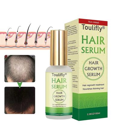 Hair Growth Serum  Hair Loss and Hair Thinning Treatment  Stops Hair Loss  Natural Herbal Essence Thinning  Balding  Repairs Hair Follicles  Promotes Thicker  Stronger Hair and New Hair Growth
