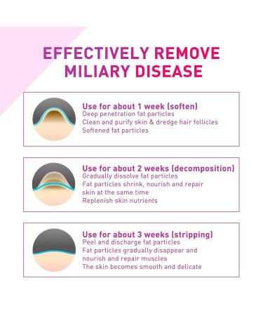 Skrskr Milia Spot Treatment | 30ml Dark Circle Corrector - Lightweight Eye Serum for Smooth Skin | Perfect Gifts for Women - Buy Online on GoSupps.com