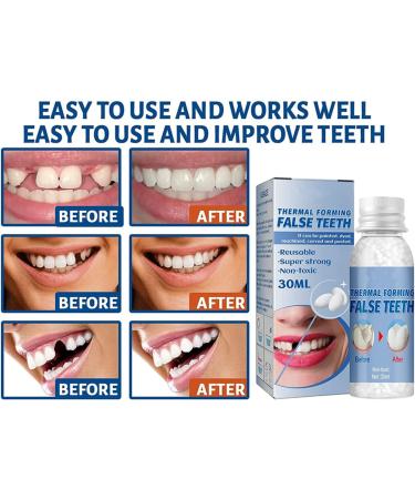Tooth Repair Granules 30ml - Reusable Temporary Tooth Repair Kit | DIY Moldable False Teeth Fitting Beads for Missing & Broken Teeth (3Pcs) - Buy Online on GoSupps.com