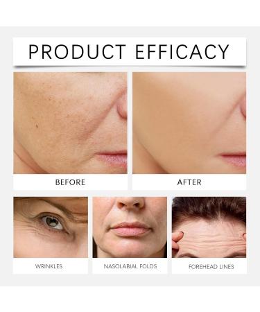 LANGSTON Restorative Body Balm for Crepey Skin and Fragile Thin Skin Firming Moisturizer for Elasticity and Vitality Fast Absorbing Daily Skincare 3.53 Oz 1can 1 Fl Oz (Pack of 1) - Buy Online on GoSupps.com