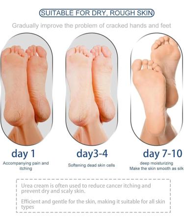 EXQST Foot Cream with 42% Urea for Dry and Cracked Heels Repair Hand and Foot Cream Stick Moisturizing Lotion for Dry Cracked Feet Heel Repair - Buy Online on GoSupps.com
