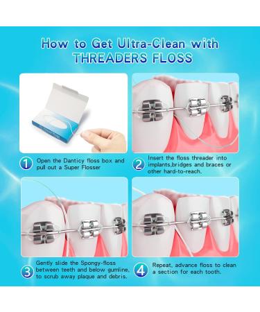 Super Floss Threaders for Braces - 60 Count | Ultimate Pre-Cut Dental Floss Strands | International Shipping Available - Buy Online on GoSupps.com
