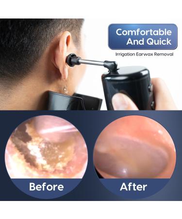 Effective Ear Wax Removal Tool Kit | Water Powered Ear Cleaner with 3 Modes & IPX7 Waterproof Design - Buy Online on GoSupps.com