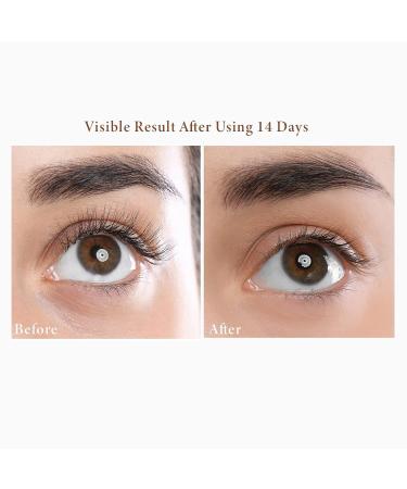 NEW ANGANCE Refreshing and Firming Eye Cream Moisturizes the Tender Eye-Contour Skin Reduces Eye Bags Crow's Feet Fine Lines  0.7 Fl Oz Firming Eye Cream Firming Eye Cream - Buy Online on GoSupps.com