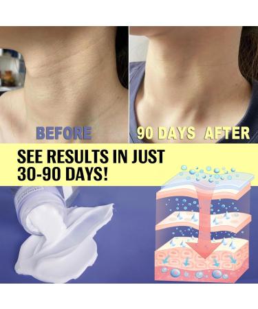 Neck Firming Cream for Face - Tightening & Lifting Neck & Chin Cream Moisturizing 1.7 Oz for Men & Women - Buy Online on GoSupps.com