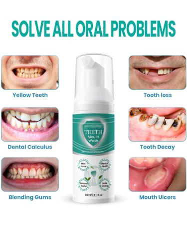 Jorondy Teeth Whitening Mousse Mouthwash - Herbal Brightening Foam for Deep Cleaning & Fresh Breath (2PCS) - Buy Online on GoSupps.com