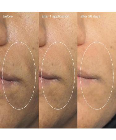 Dermalogica Liquid Peelfoliant - Glycolic Acid Face Exfoliator Peel | Smooth Fine Lines Unclog Pores Improve Skin Tone - 2 fl oz - Buy Online on GoSupps.com