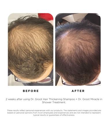 Dr. Groot Scalp Revitalizing Solution Travel Set | Hair Thickening Shampoo & Treatment | TSA Approved Korean Hair Care with Rosemary Oil - Buy Online on GoSupps.com