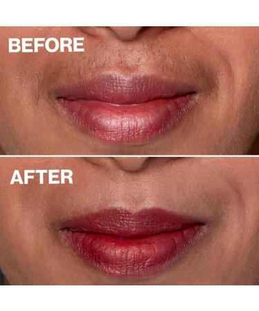 Skinetic Peach Fuzz Hair Removal Cream - 100g Gentle Face Hair Remover for Women | Mustache & Lip Hair Solution (3 Pieces) - Buy Online on GoSupps.com