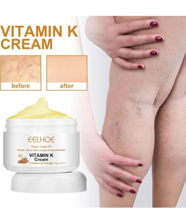 2023 New Varicose Veins Miracle Cream - Natural Treatment for Legs (2 Pack) | International Shipping Available - Buy Online on GoSupps.com