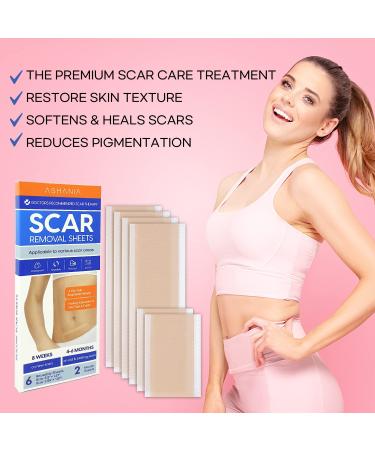 Silicone Scar Removal Sheets for Old & New Scars - 6 Sheets (2 Sizes) - Effective Treatment - Diverse Scars - 5.9 x 1.57 & 2.95 x 1.57 - Buy Online on GoSupps.com