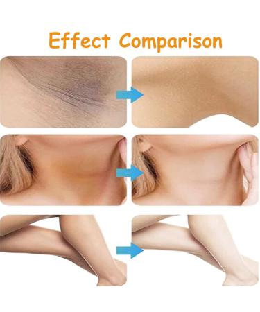 LAIKME Dark Spot Corrector Cream for Body Underarm Elbows Knees Neck Armpit Vitamin C Dark Spot Remover for Sun Spot Aging Spot Freckle Melasma Moisturizing Skin Lightweight Fast Absorbing - Buy Online on GoSupps.com
