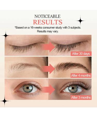 Generic Lash Serum for Eyelash & Eyebrow Growth - Natural Enhancer for Longer Fuller Lashes & Brows - Buy Online on GoSupps.com