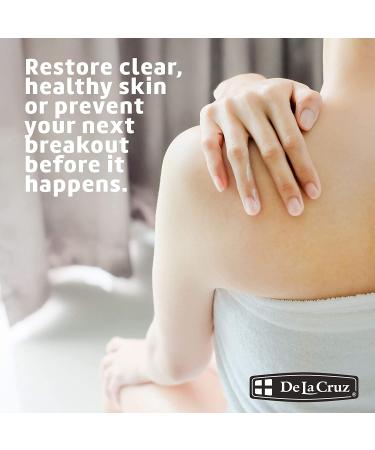 De La Cruz Acne Treatment Ointment - 5% Sulfur, 2.6 oz (74 g) | Effective Acne Solution - Buy Online on GoSupps.com